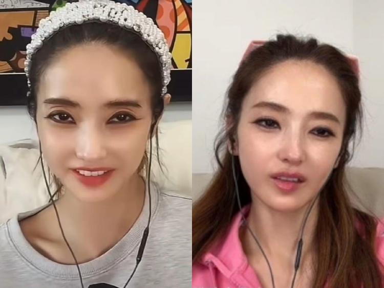 한채영 라방 근황 걱정 확산